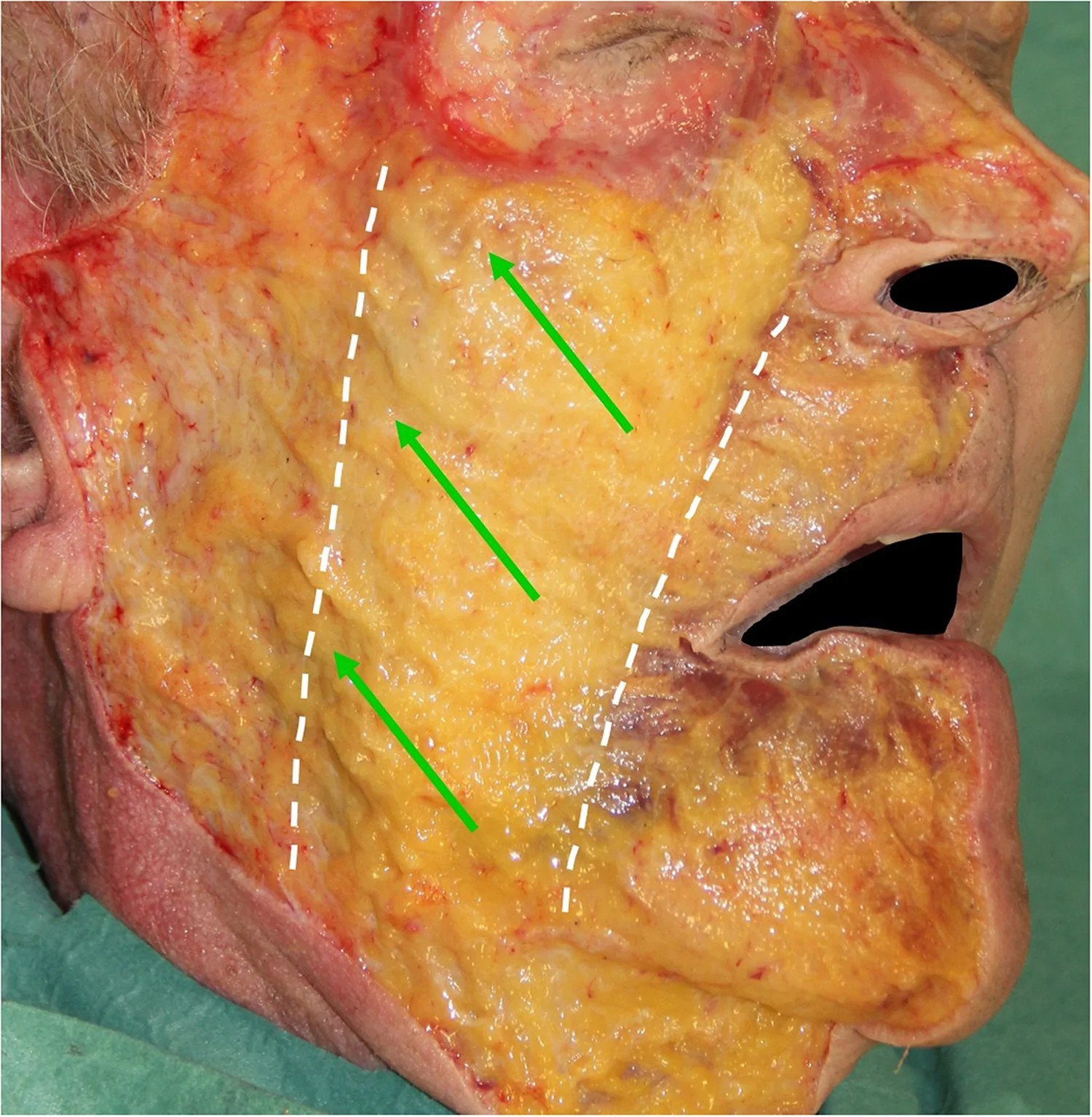 Fig. 4