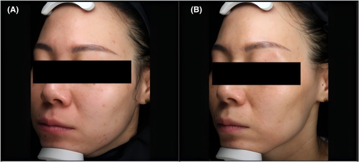 FIGURE 1
