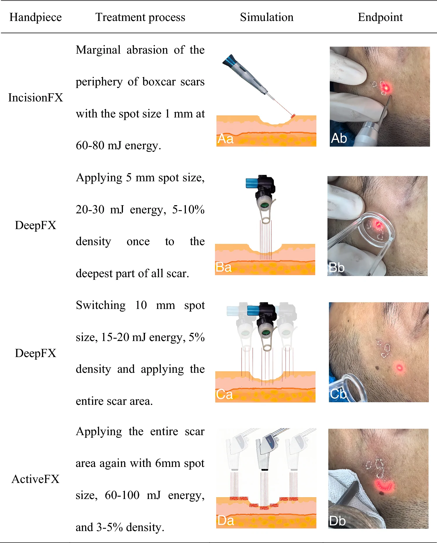 CaHA联合CO2点阵激光萎缩性痤疮瘢痕