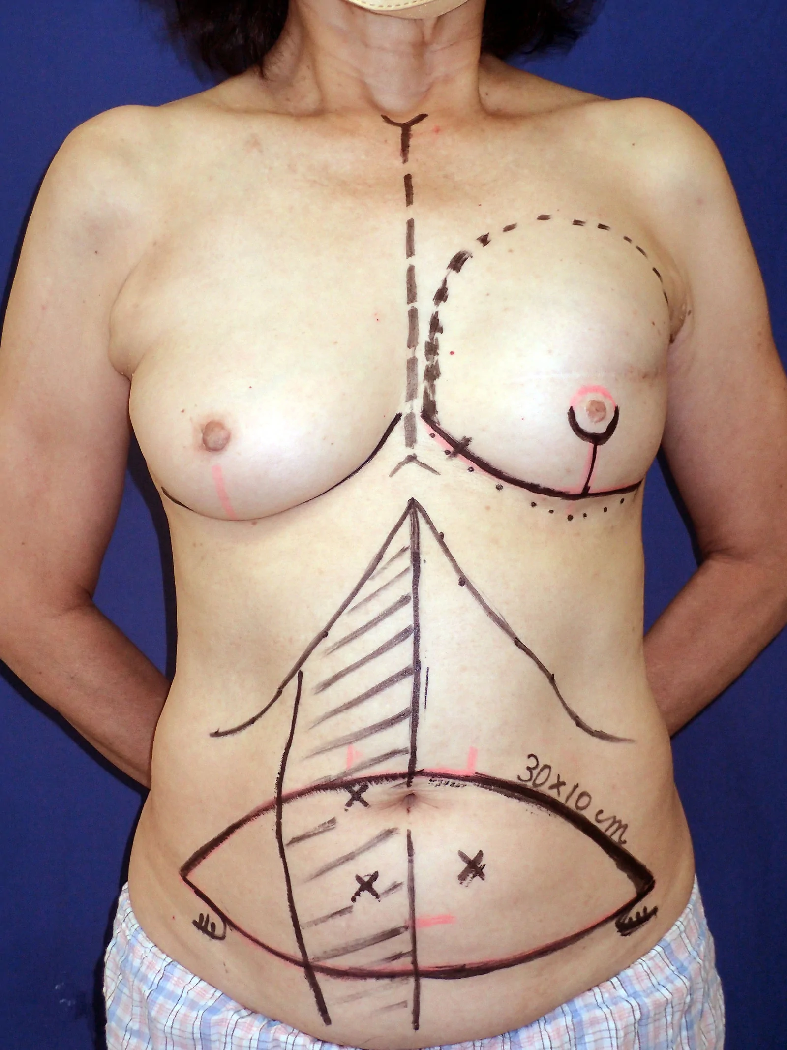 Fig. 2.