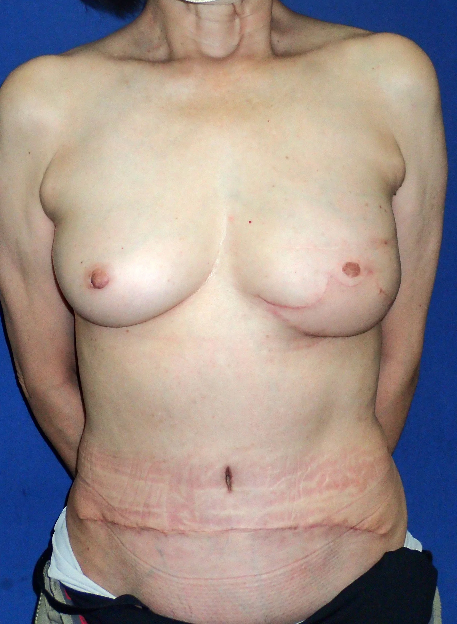Fig. 4.
