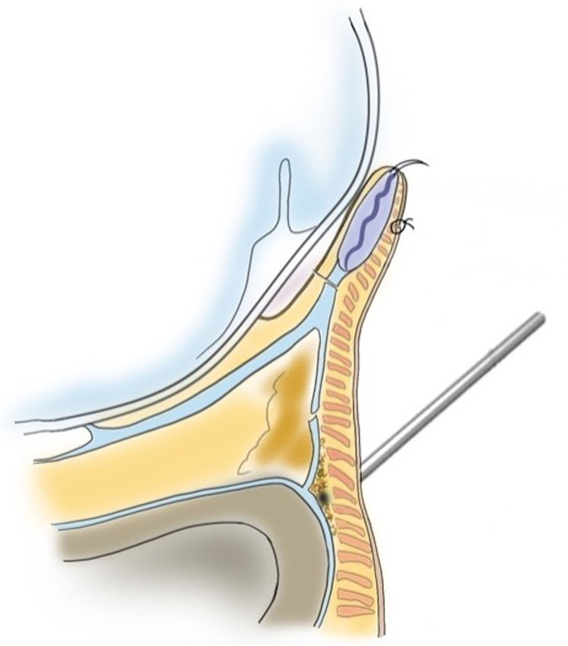 Fig. 5.