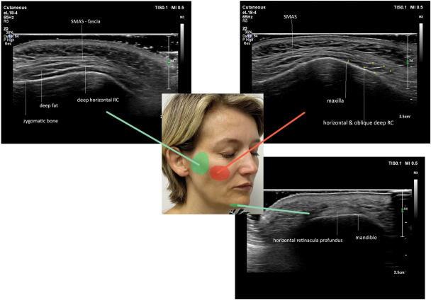 Figure 2.