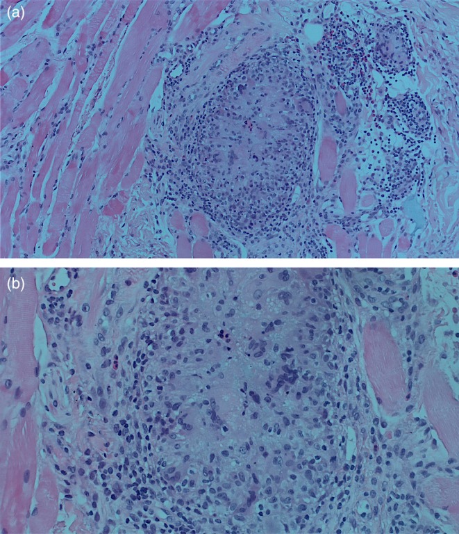 FIGURE 2
