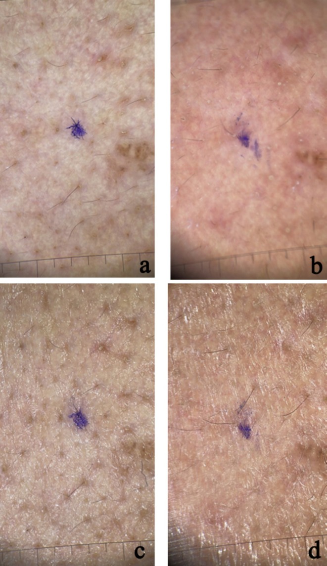 FIGURE 3