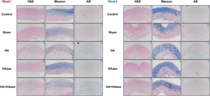 FIGURE 3