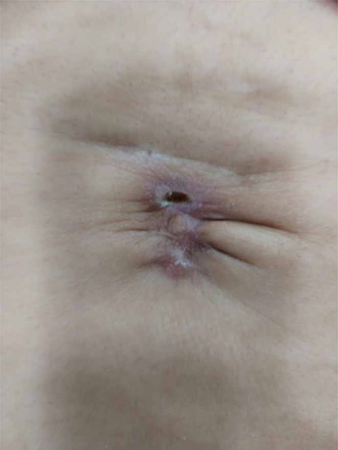 FIGURE 13