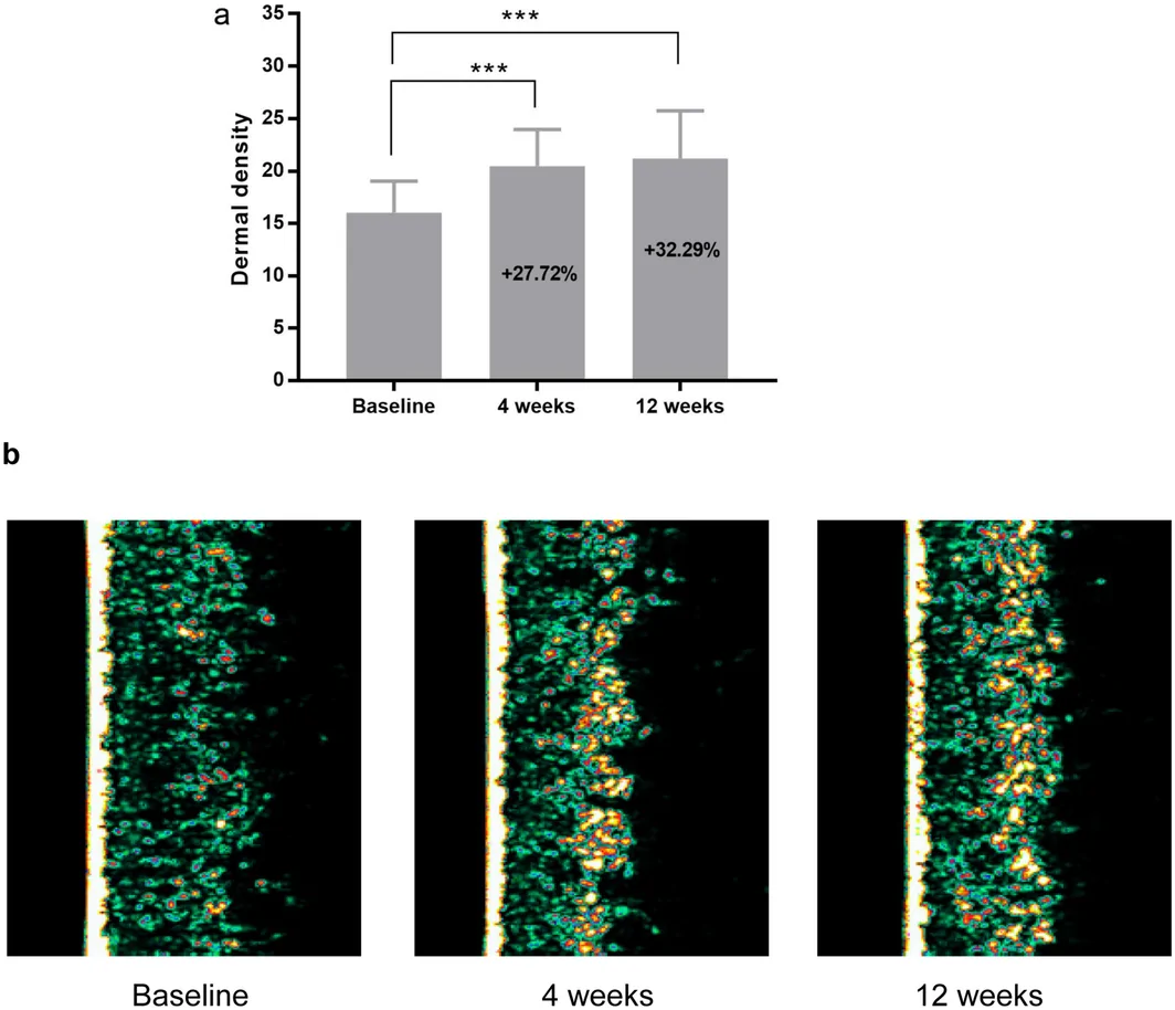 FIGURE 4
