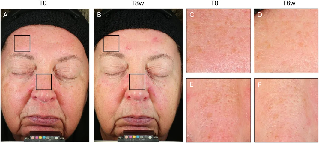 FIGURE 3