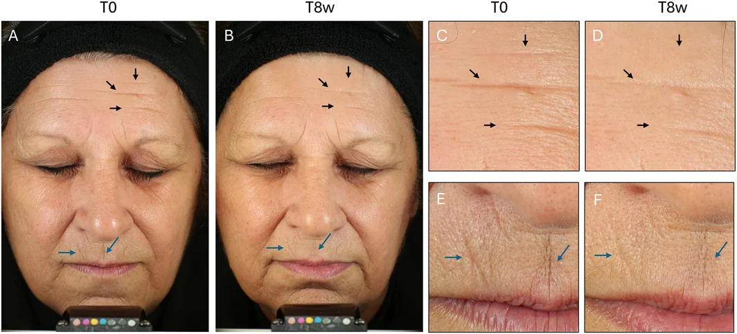 FIGURE 6