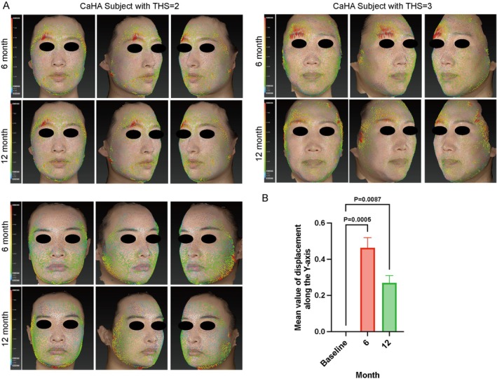 FIGURE 3