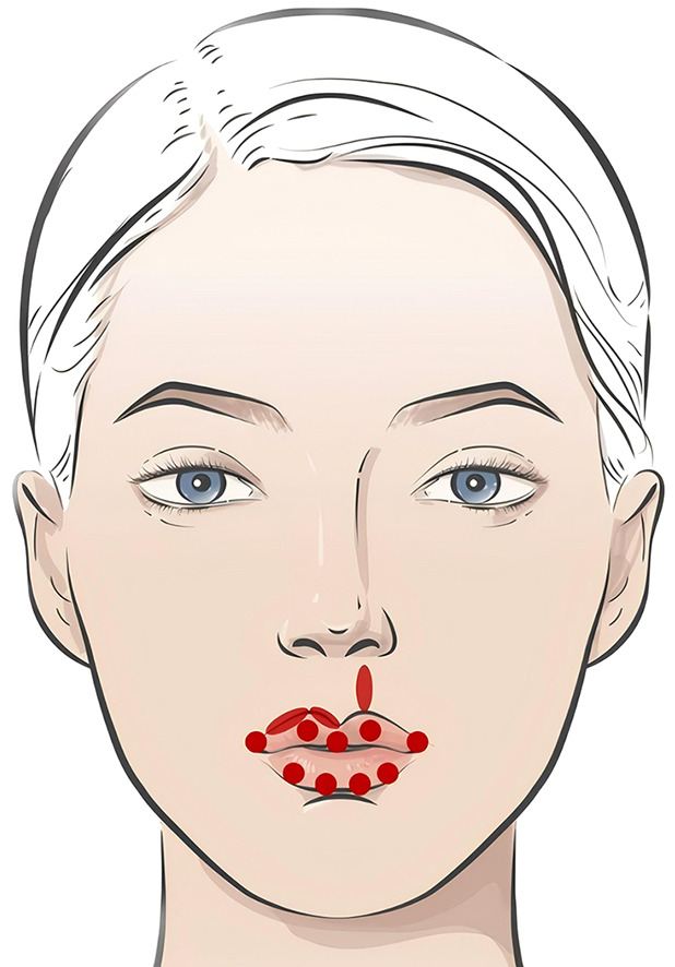 Figure 14