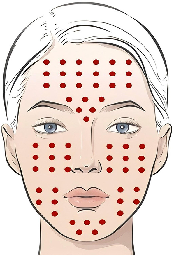 Figure 16