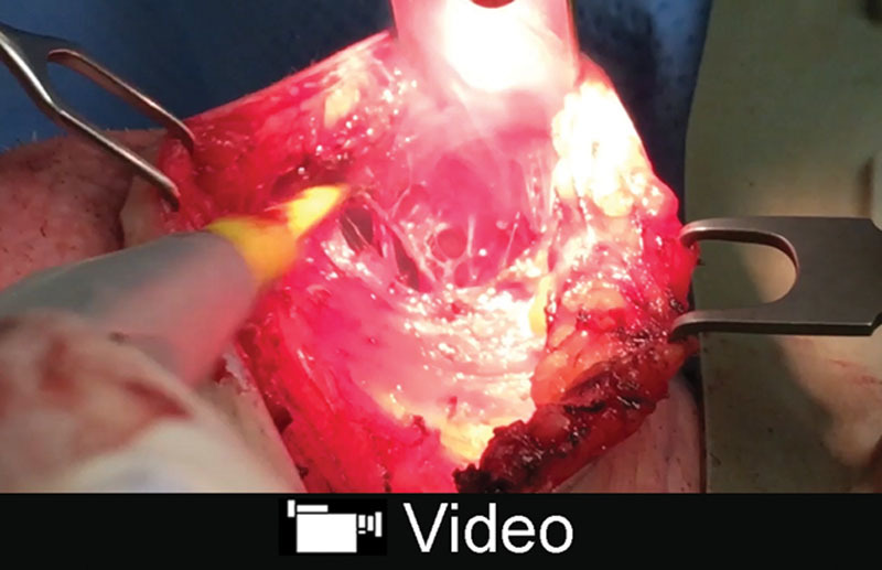 Video Graphic 1.