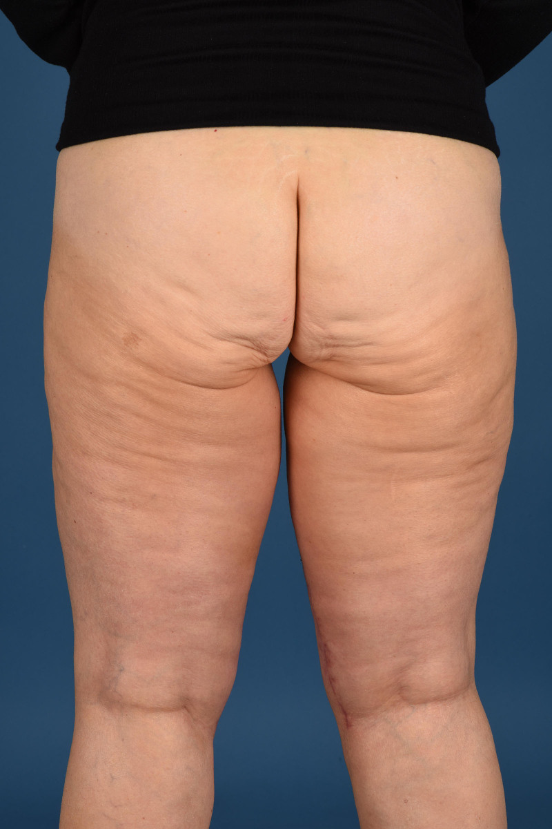 Fig. 13.