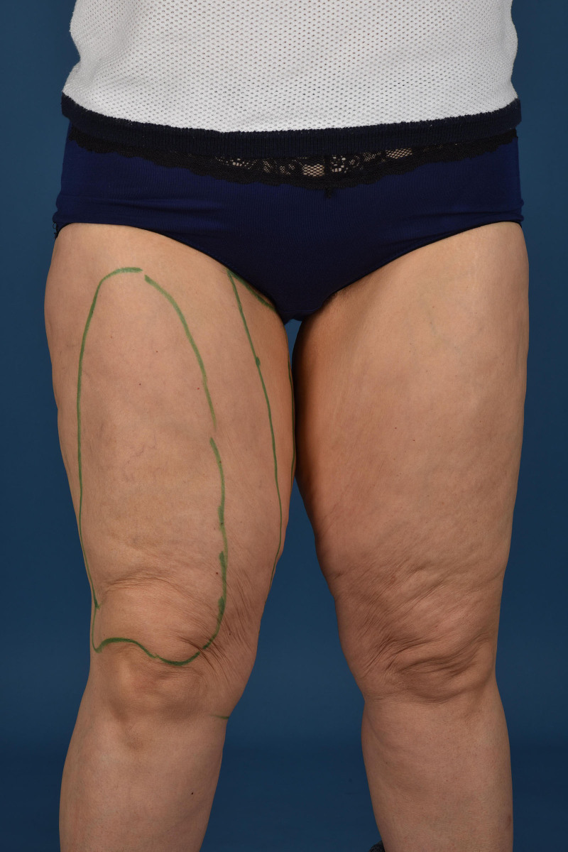 Fig. 14.