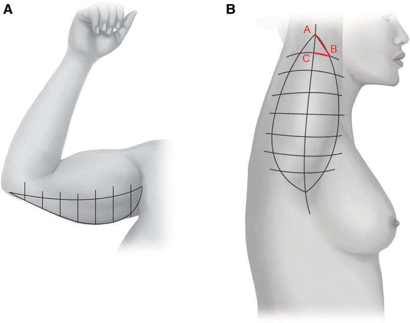 Fig. 16.