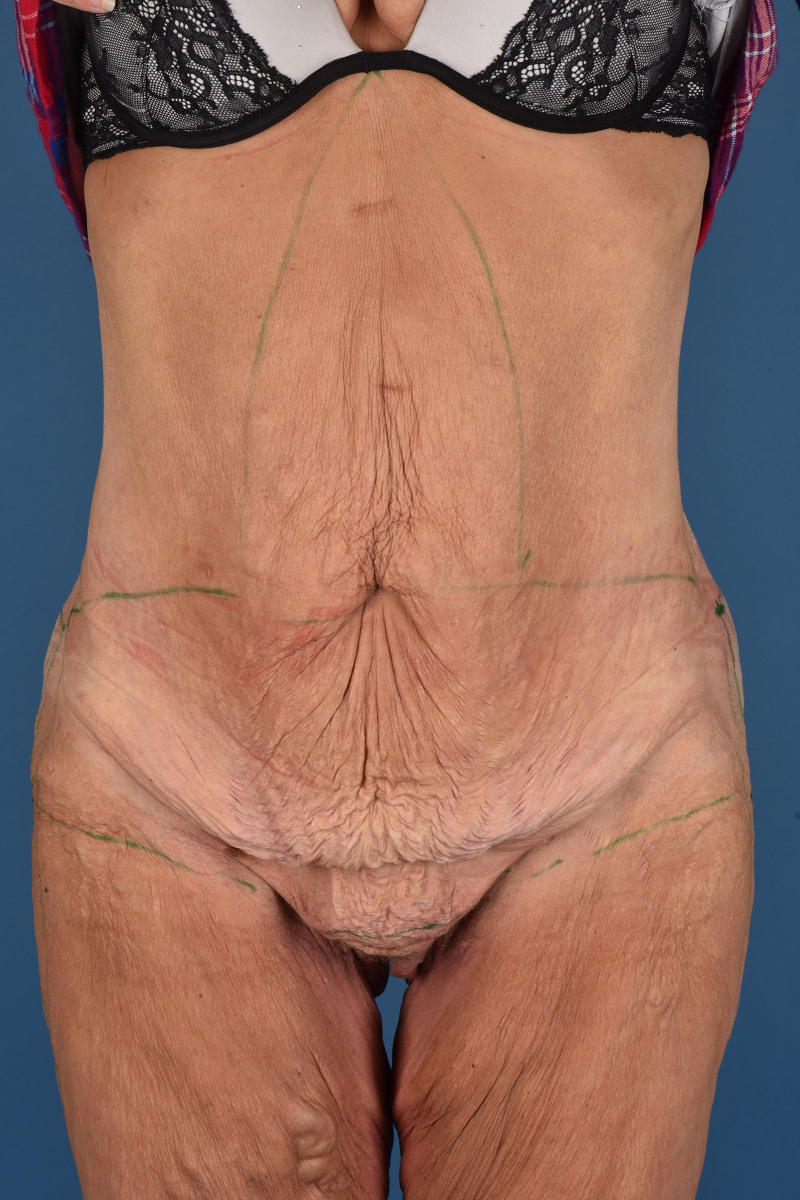 Fig. 8.