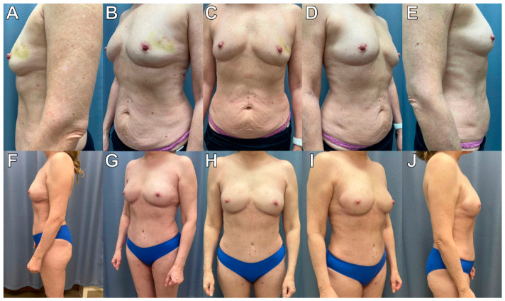 Figure 13