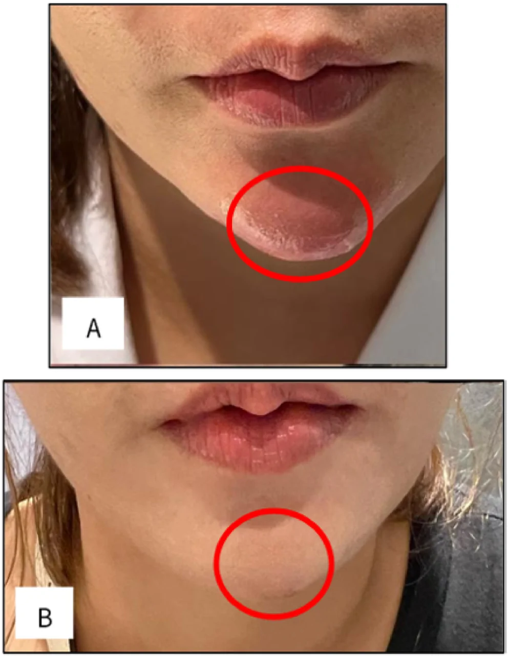 FIGURE 4
