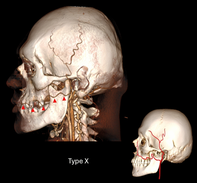 Fig. 10