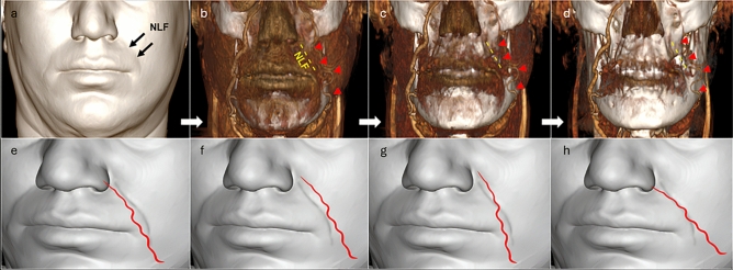 Fig. 11