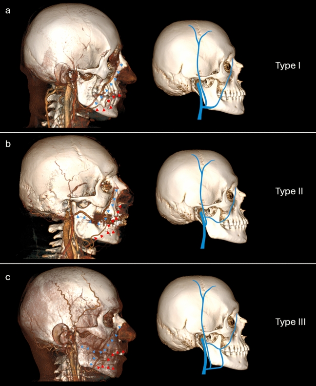 Fig. 12