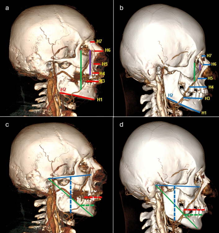 Fig. 13