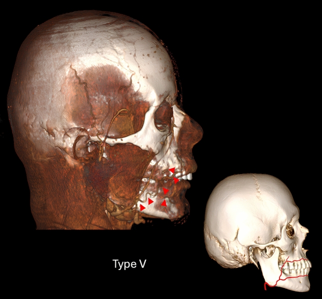 Fig. 5