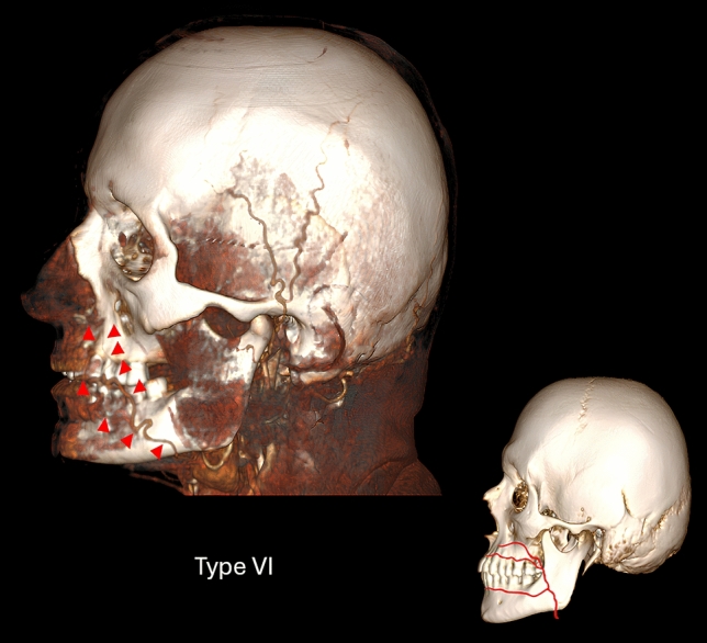 Fig. 6