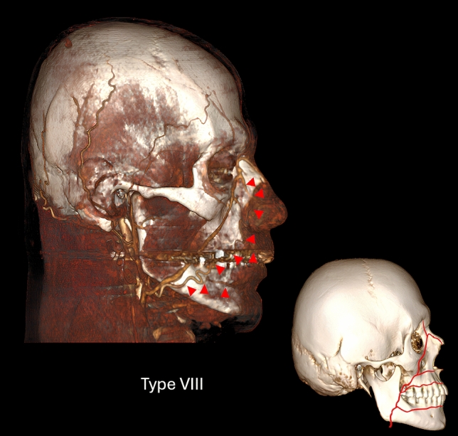 Fig. 8