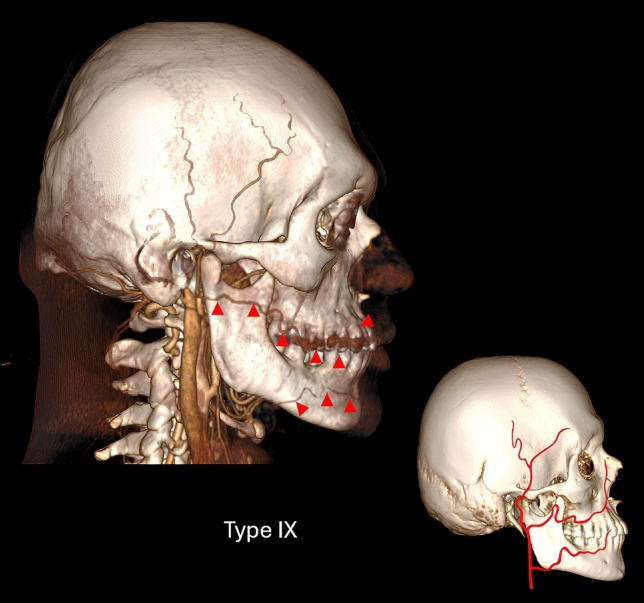 Fig. 9