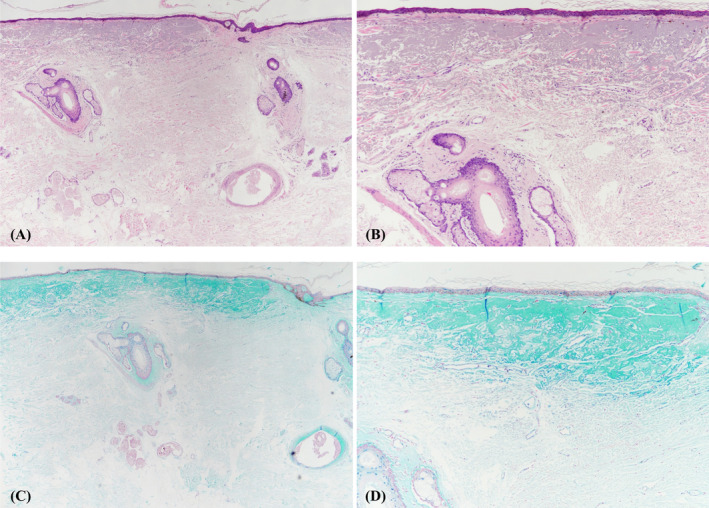 FIGURE 3