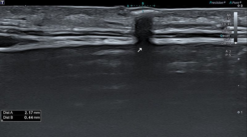 Fig. 11.