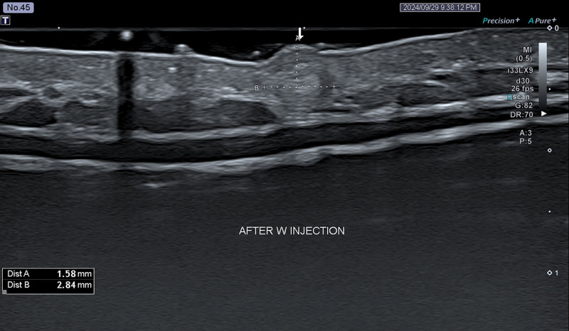 Fig. 8.