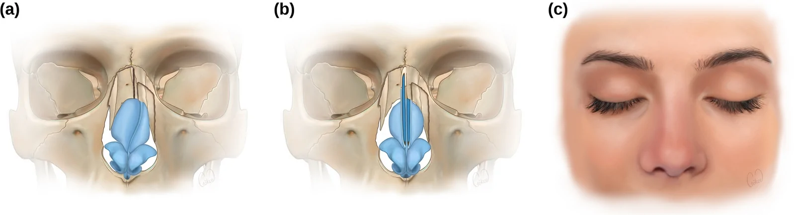 Fig. 7