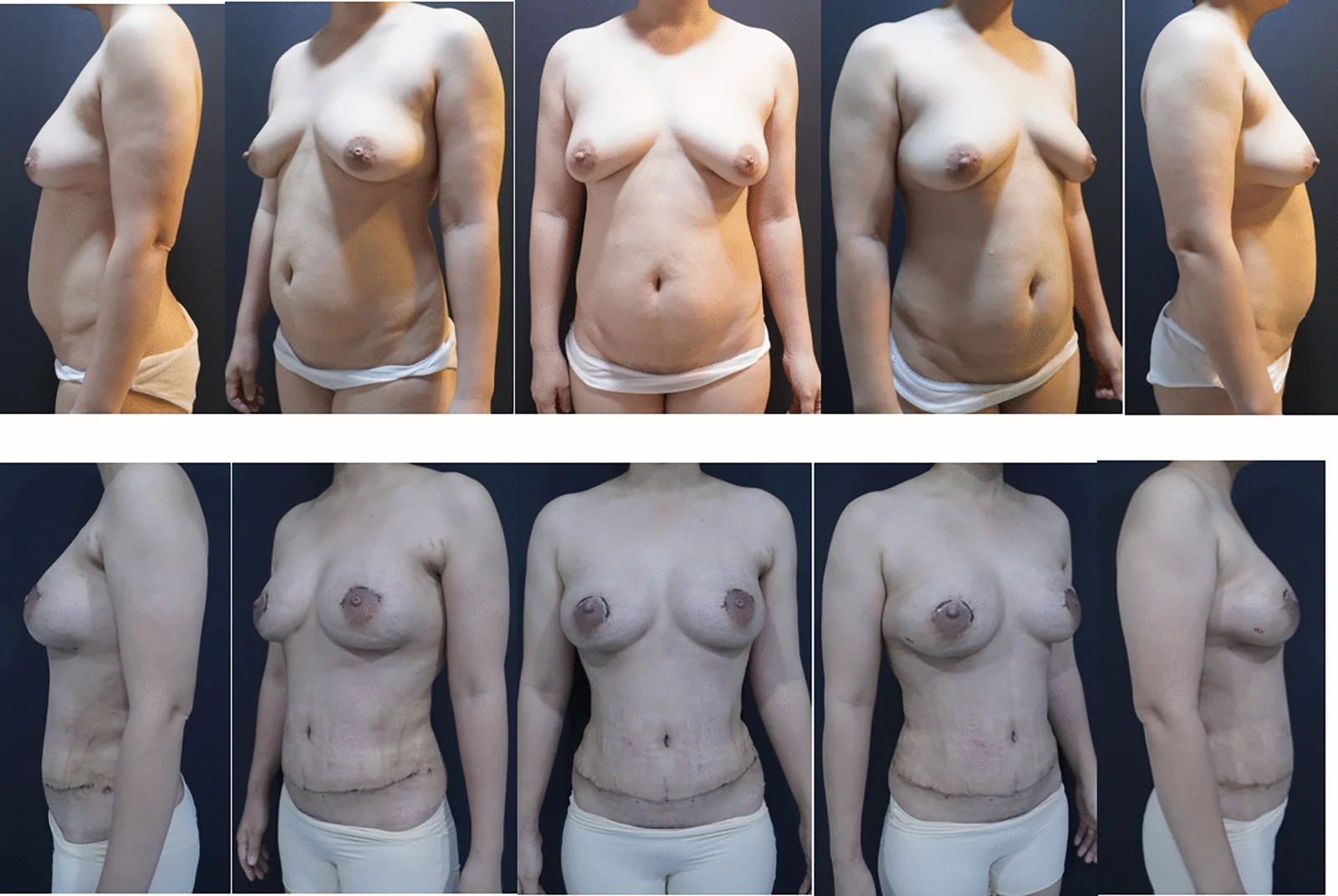 Fig. 4