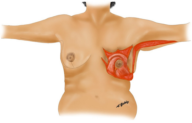 Fig. 11