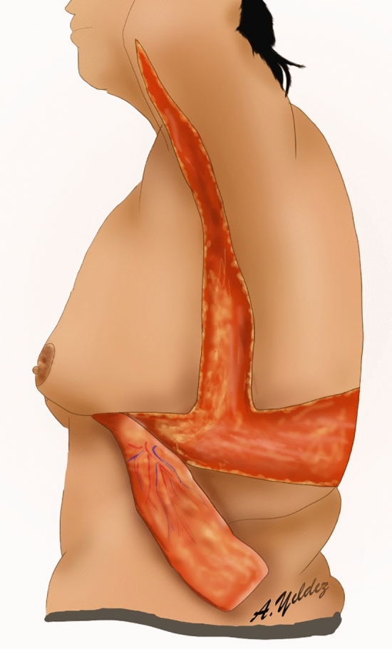 Fig. 14