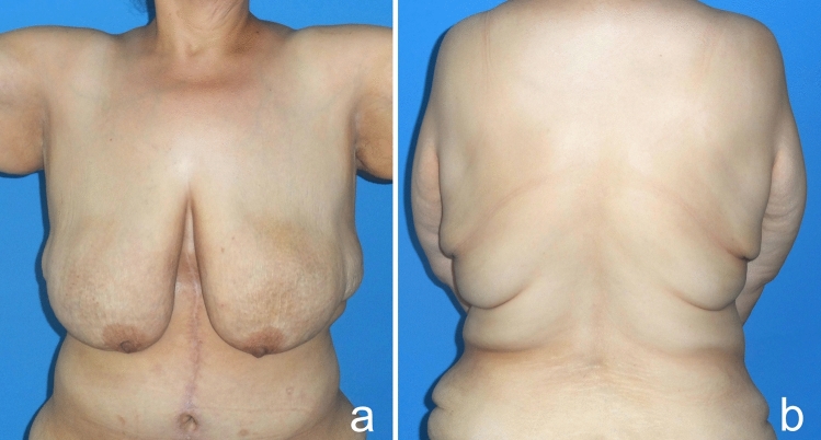 Fig. 15