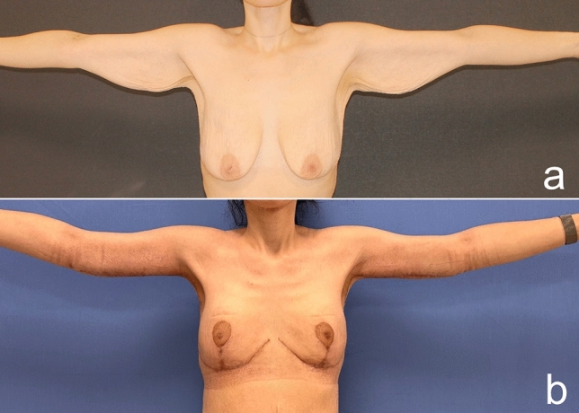 Fig. 18