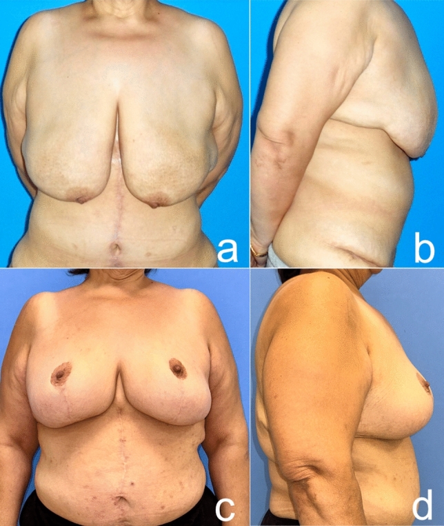 Fig. 19