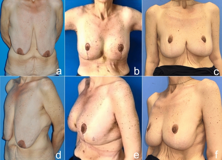 Fig. 20