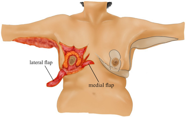 Fig. 5