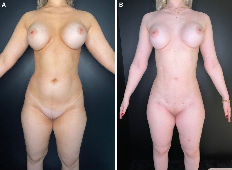 Fig. 7.