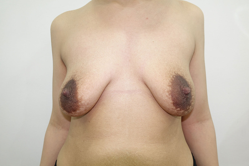 Fig. 15.