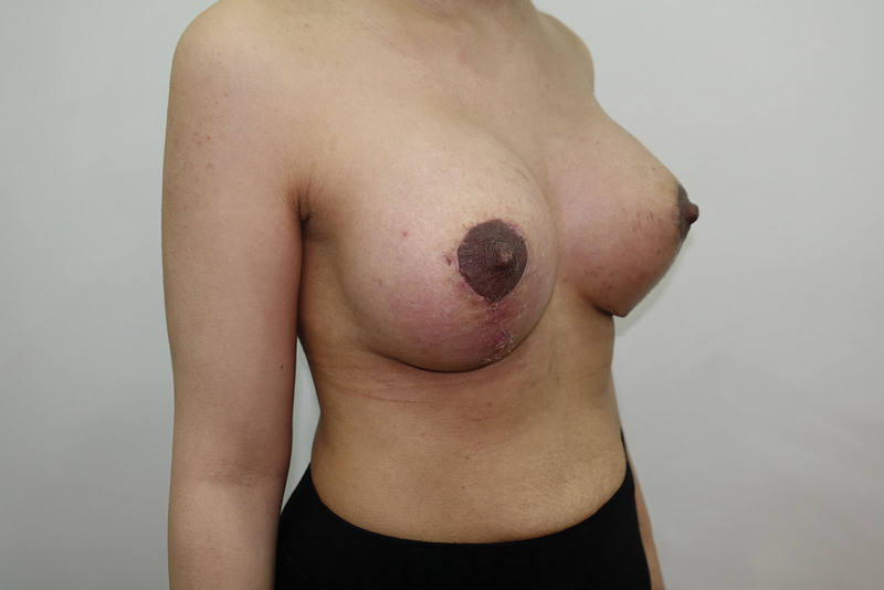 Fig. 19.