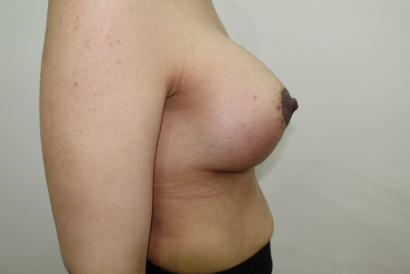 Fig. 20.