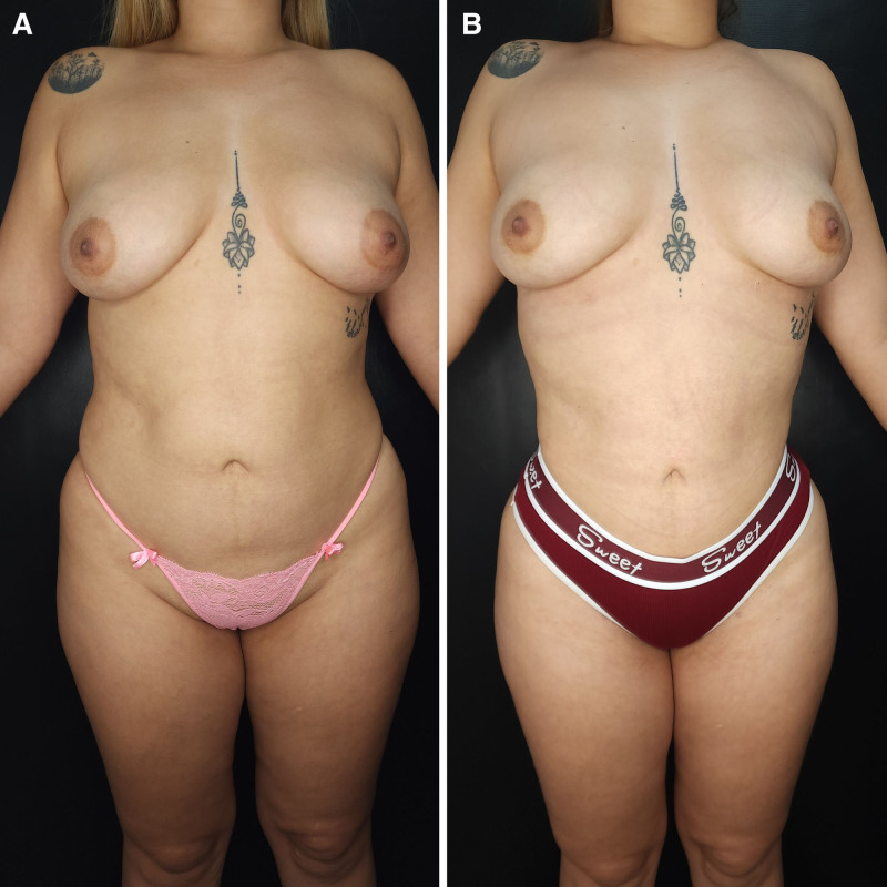 Fig. 4.
