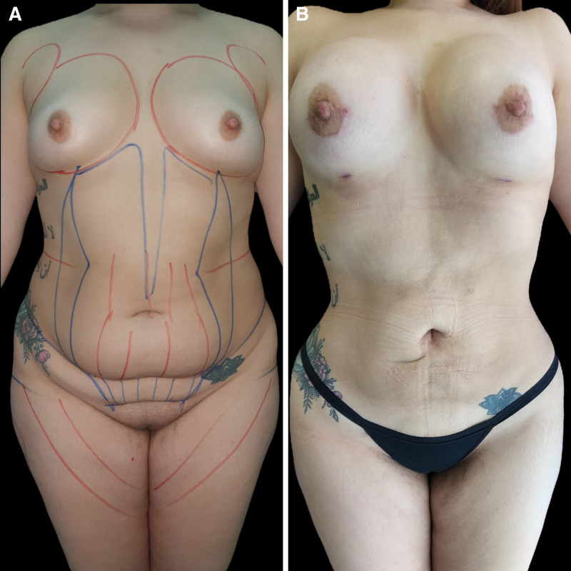 Fig. 6.
